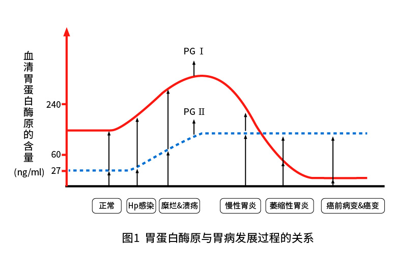 胃蛋白酶原Ⅰ(PGⅠ)和胃蛋白酶原Ⅱ(PGⅡ)與胃部疾病的關(guān)系 胃蛋白酶原Ⅰ(PGⅠ)和胃蛋白酶原Ⅱ(PGⅡ)與胃部疾病的關(guān)系